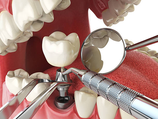 Best Broken or Cracked Tooth Emergency Dentist in Tinton Falls, NJ